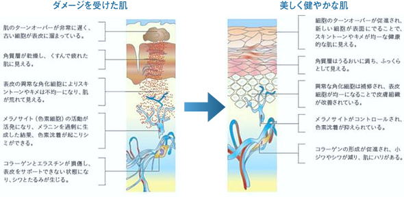 ダメージを受けた肌 美しく健やかな肌